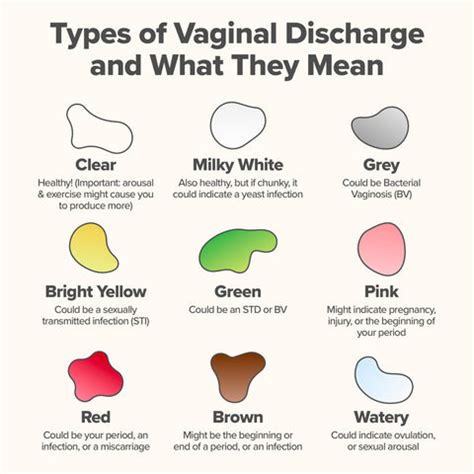 discharge traduction|types of vaginal discharge.